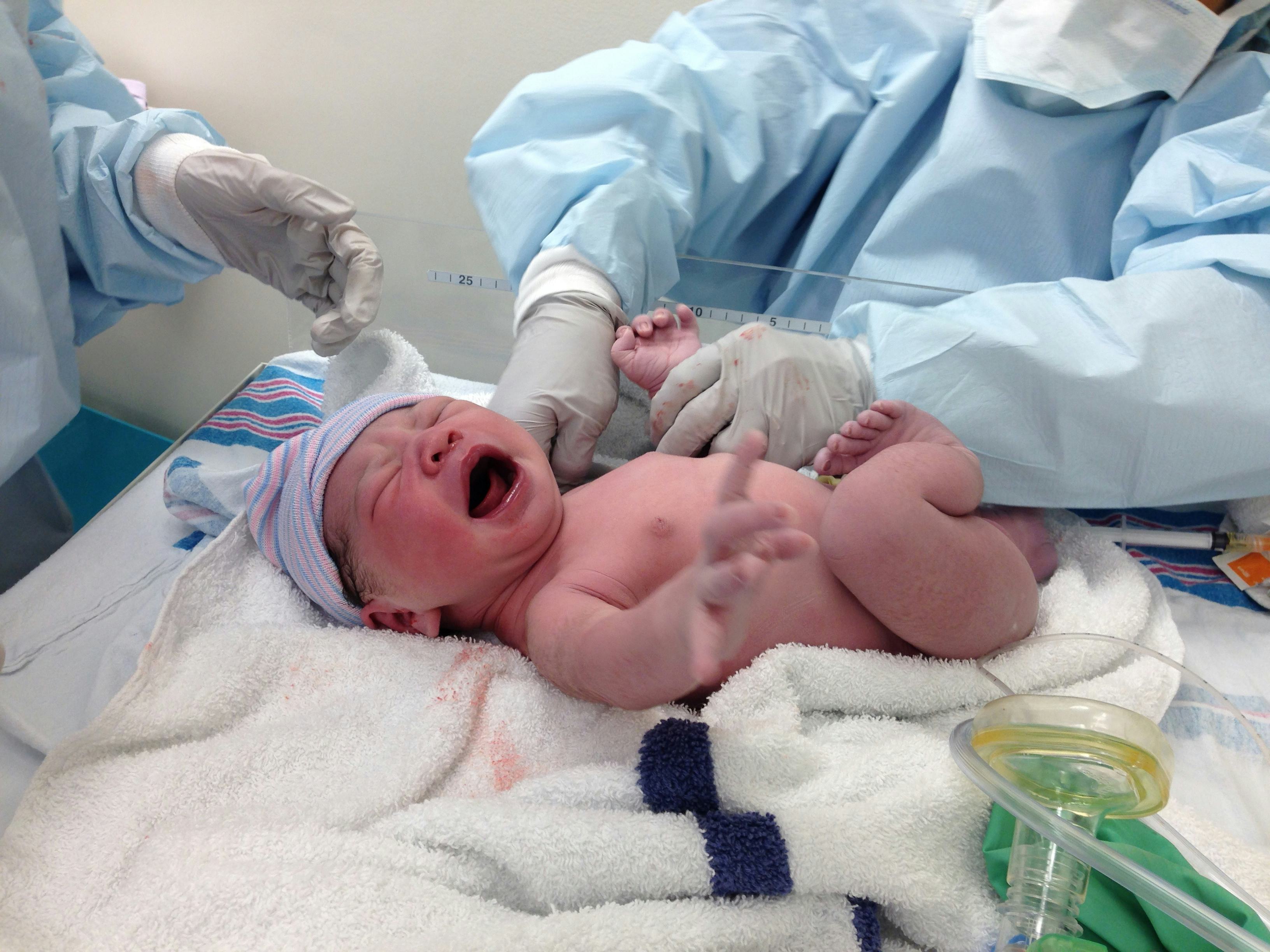 A crying newborn baby, being handled by nurses 