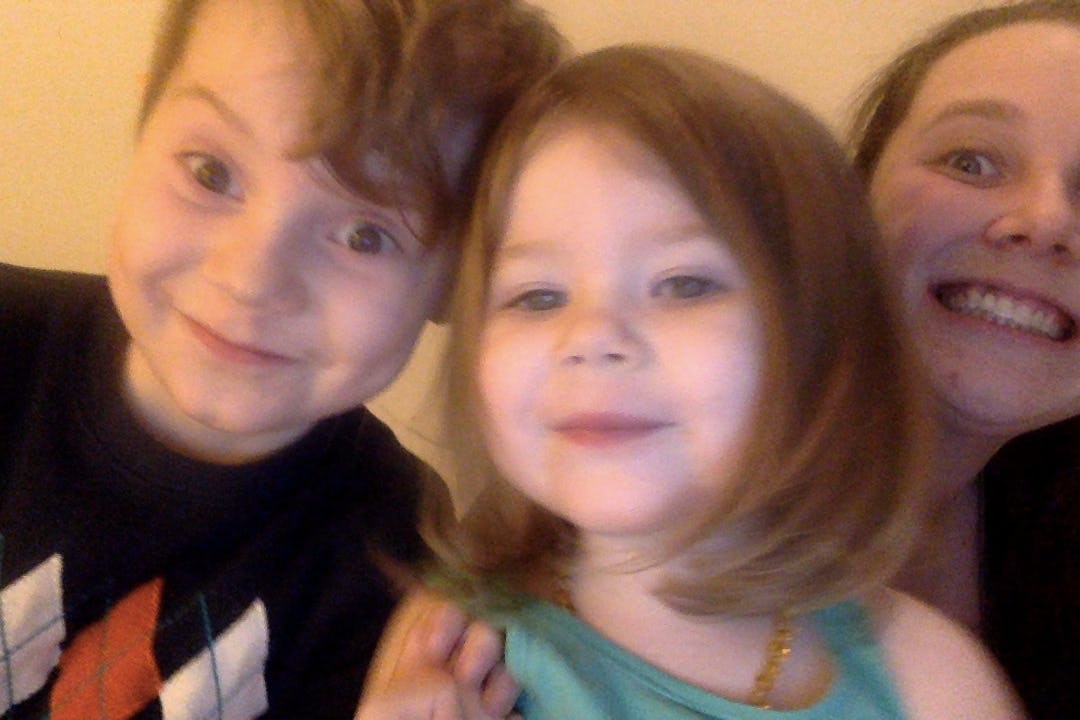 I Tried Coconut Oil Pulling For A Week & This Is What Happened