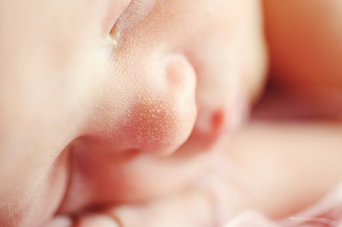 A baby with thrush sleeping