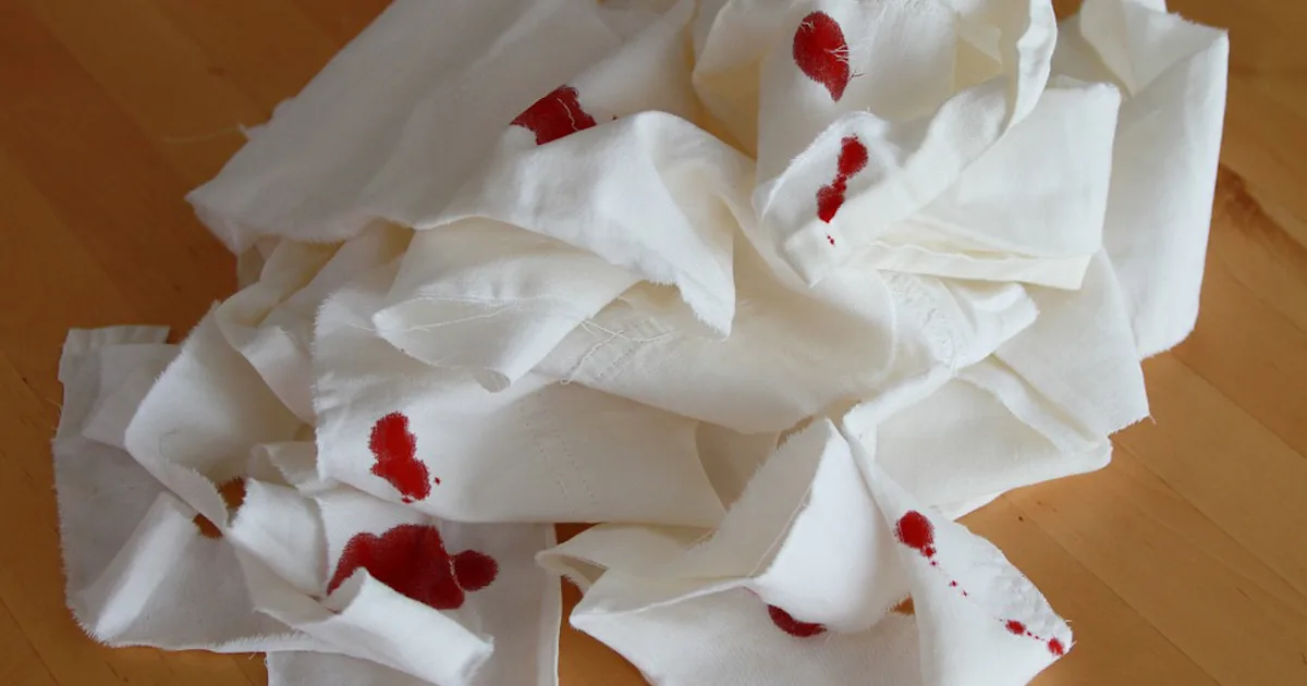 Is It Normal To Bleed During Sex