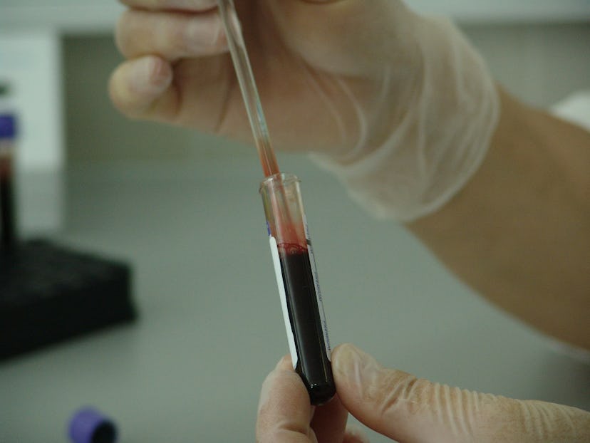 A doctor using a tube with blood to get it tested