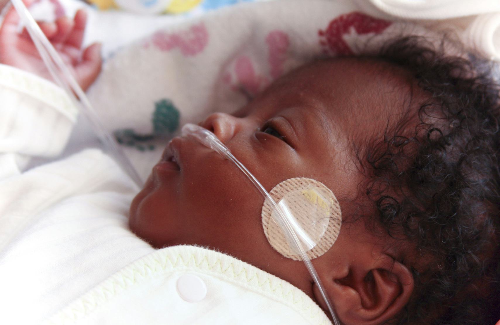 7th month premature baby
