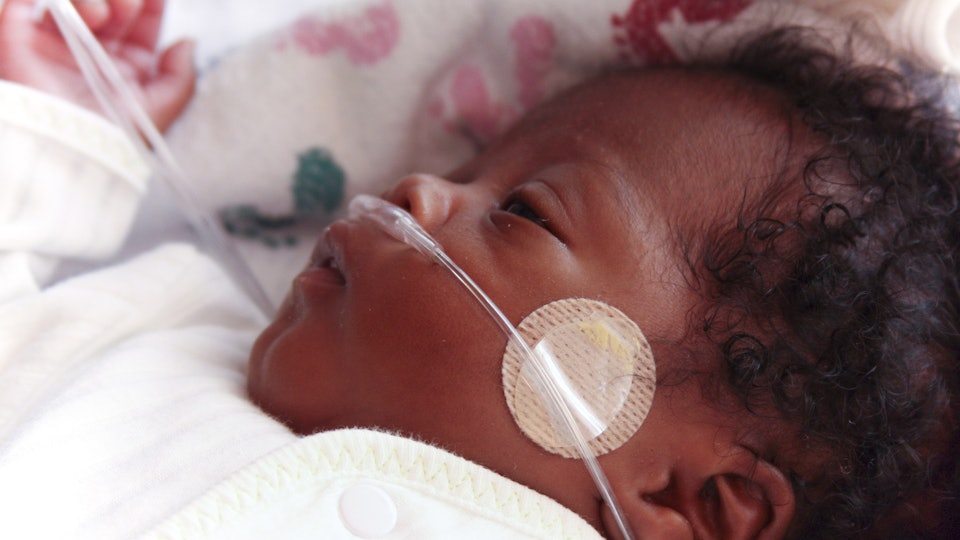 11 Problems Premature Babies May Face Later In Life