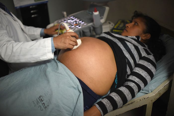 Microcephaly pregnant mother at a control in hospital