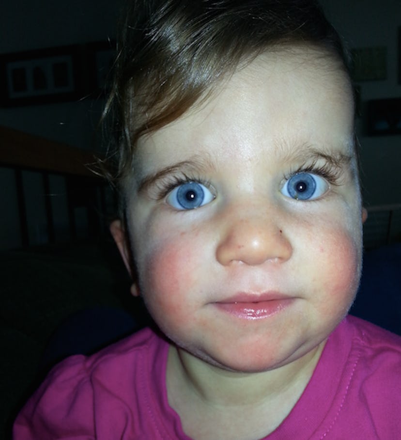 Emily Halls' daughter with Ogden syndrome