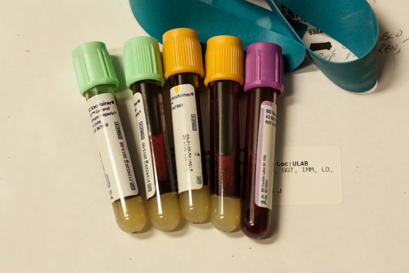 Five vials with the blood sample