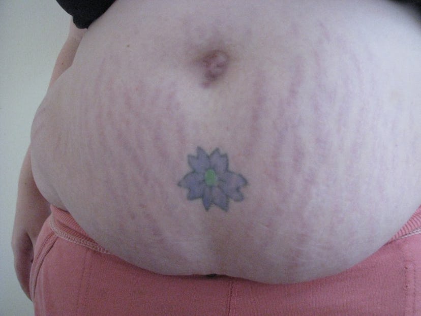 Before image of Katherine DM Clover with stretch marks and a tattoo of a flower