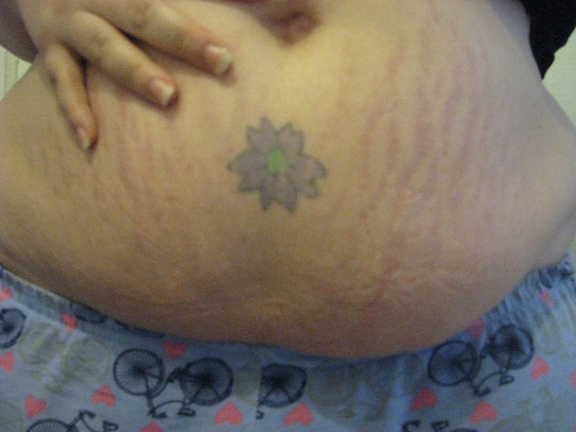 Second week image of Katherine DM Clover with stretch marks and a tattoo of a flower