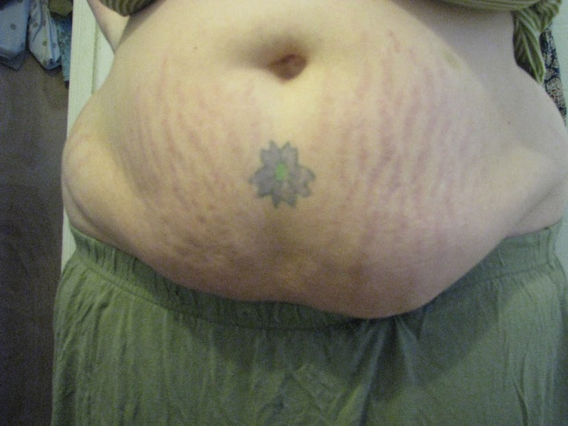 Third week image of Katherine DM Clover with stretch marks and a tattoo of a flower