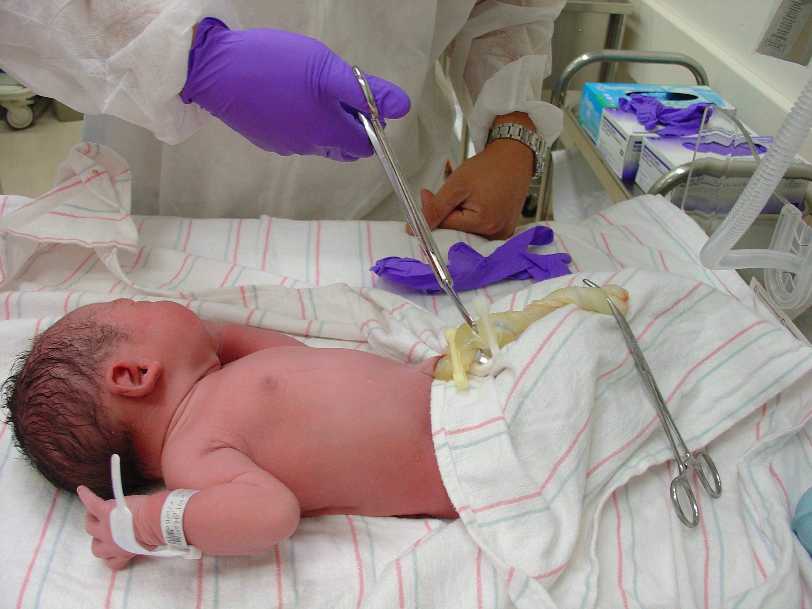 What Is An Umbilical Cord? 3 Things To Know About Your Baby’s Lifeline