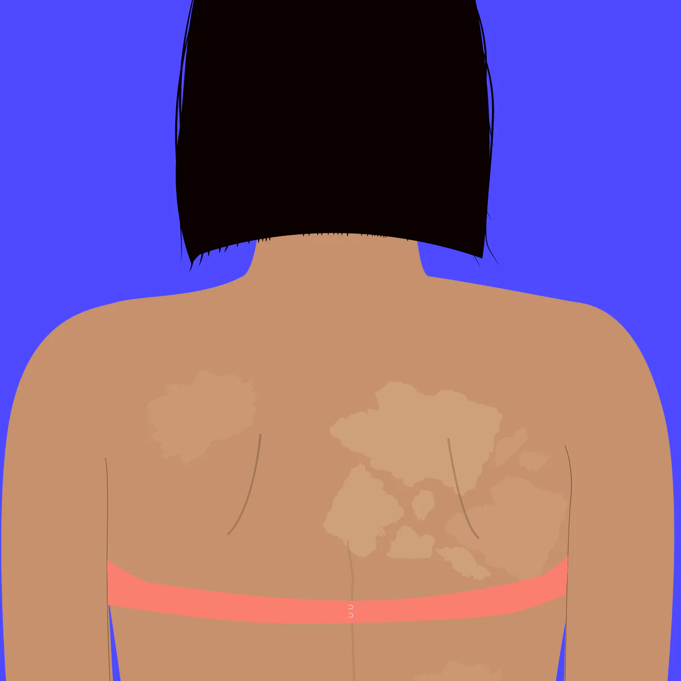 7 Skin Warning Signs You Shouldn’t Ignore