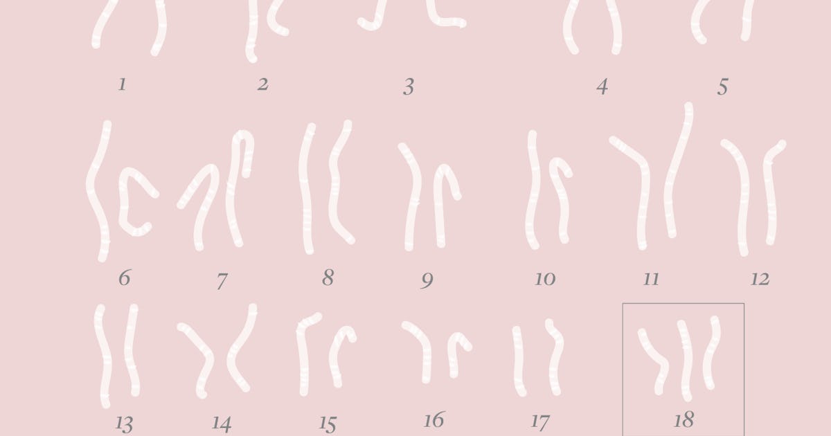 Common Chromosomal Abnormalities That Can Cause Miscarriage