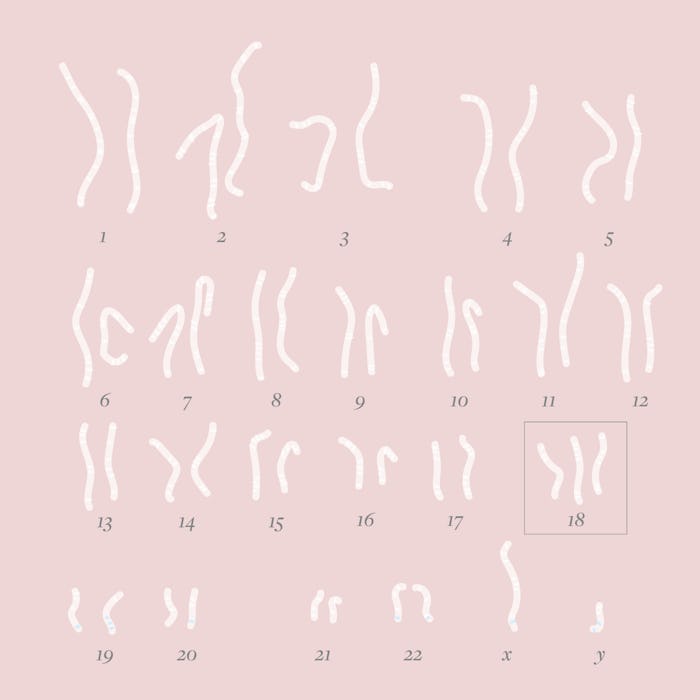 A visual representation of Common Chromosomal Abnormalities