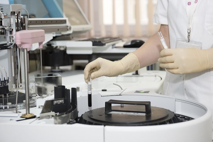 A lab technician testing blood for endometriosis 