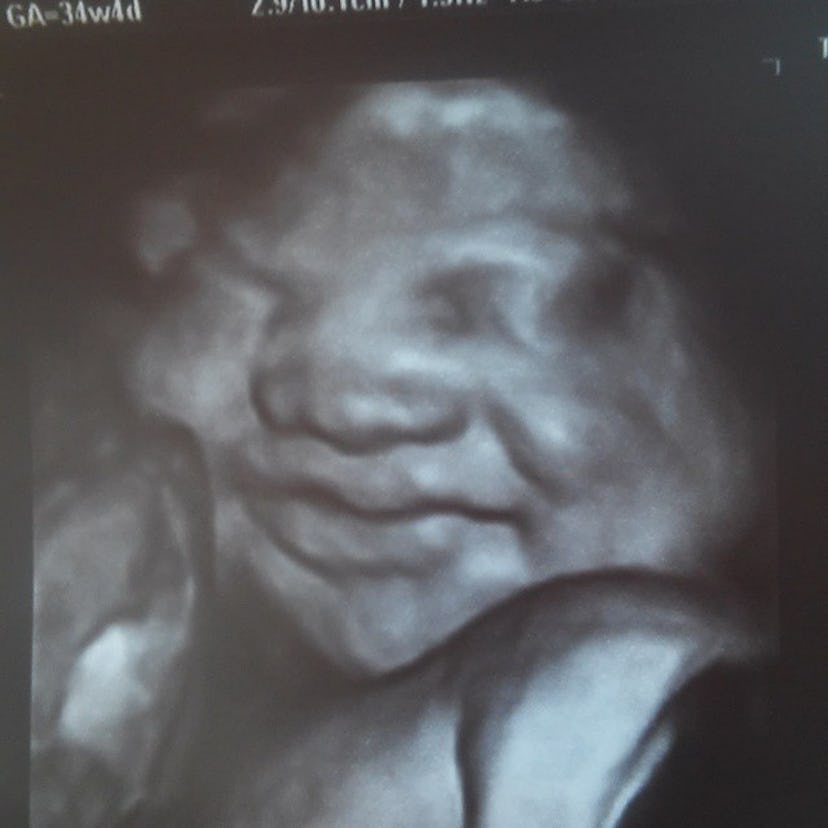 View of a baby face on ultrasound