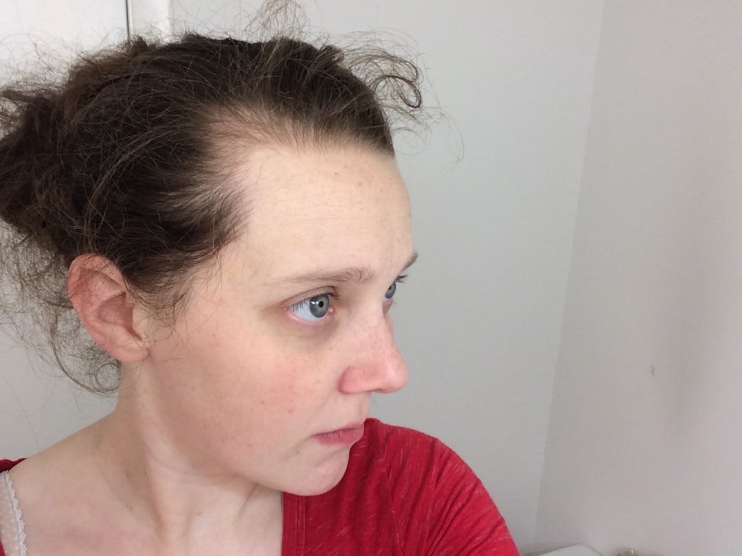 I Tracked My Postpartum Hair Loss For A Week And It Truly Grossed Me Out