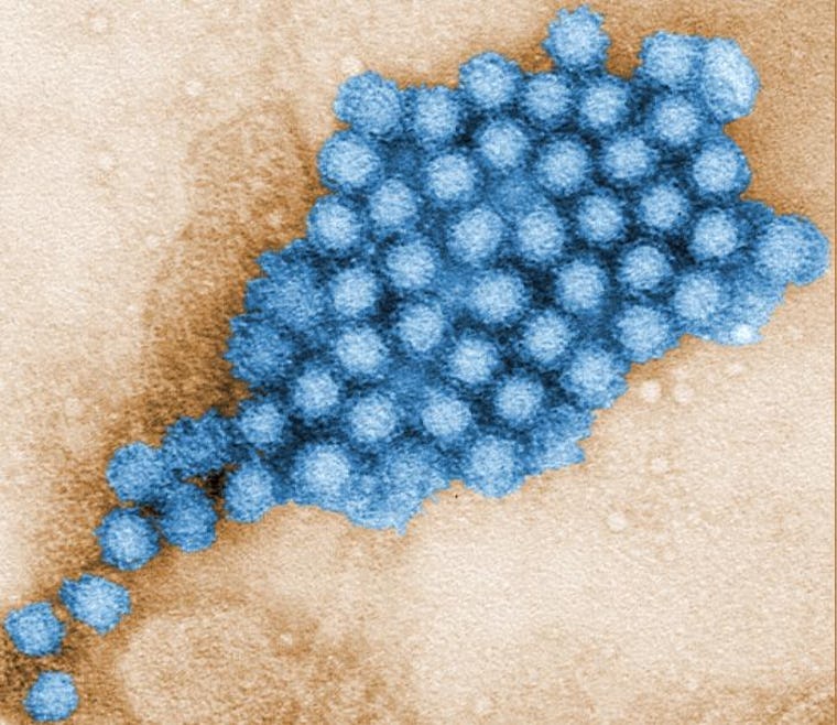 What To Do If You Have The Norovirus & Are Pregnant, Because Flu Season