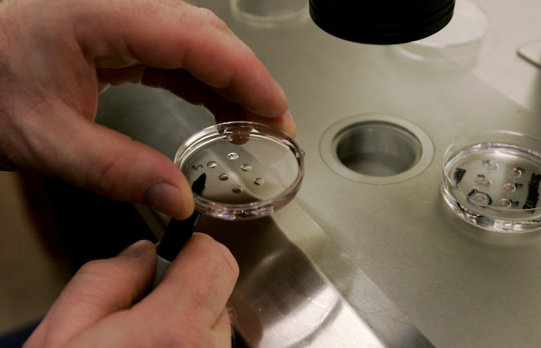 Why IVF & EggFreezing Should Be Covered By Health Insurance Why IVF & EggFreezing Should Be Covered By Health Insurance