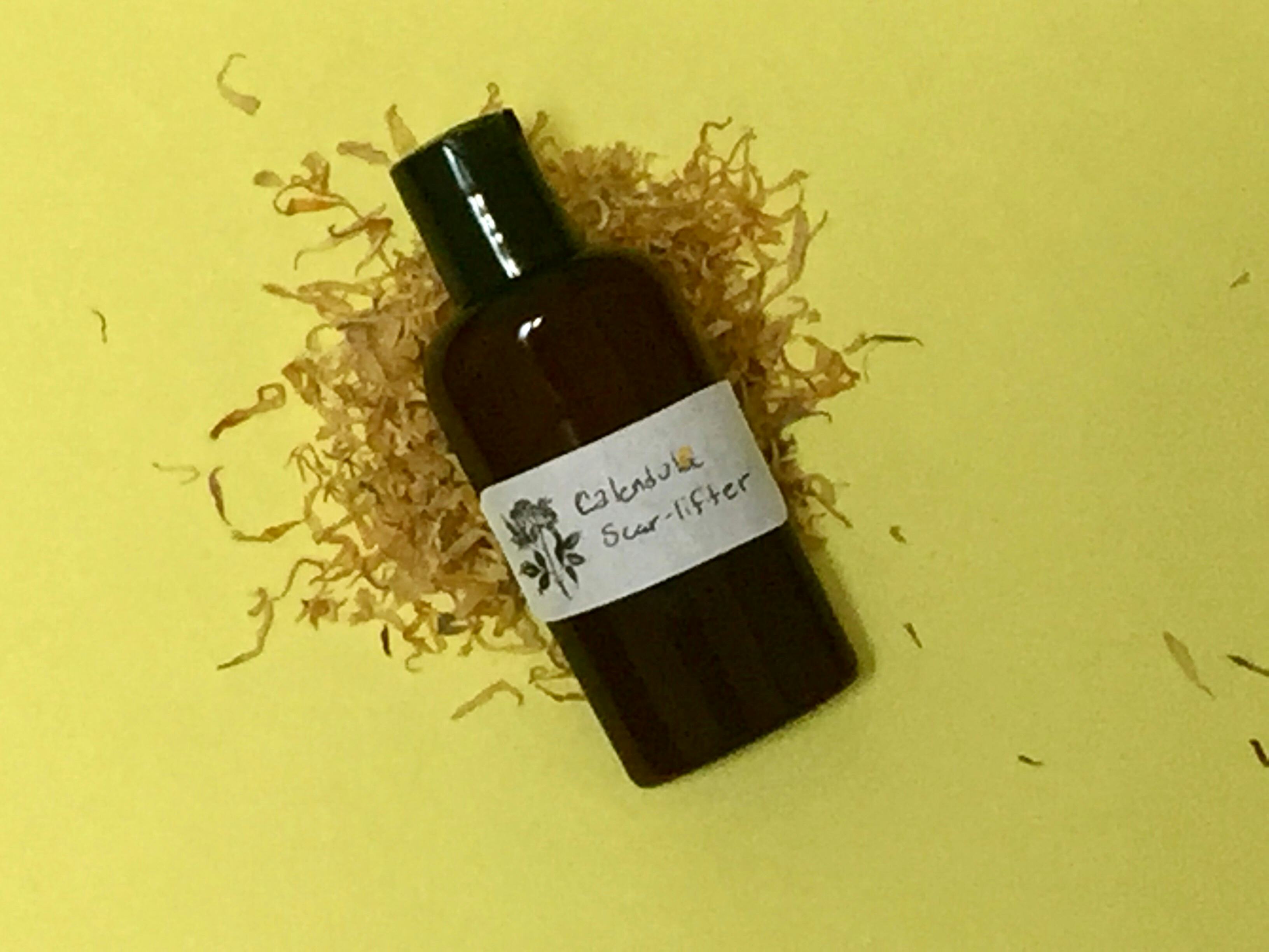 10 Natural Herbs That Will Help Heal Scars From Acne & Other Skin Issues