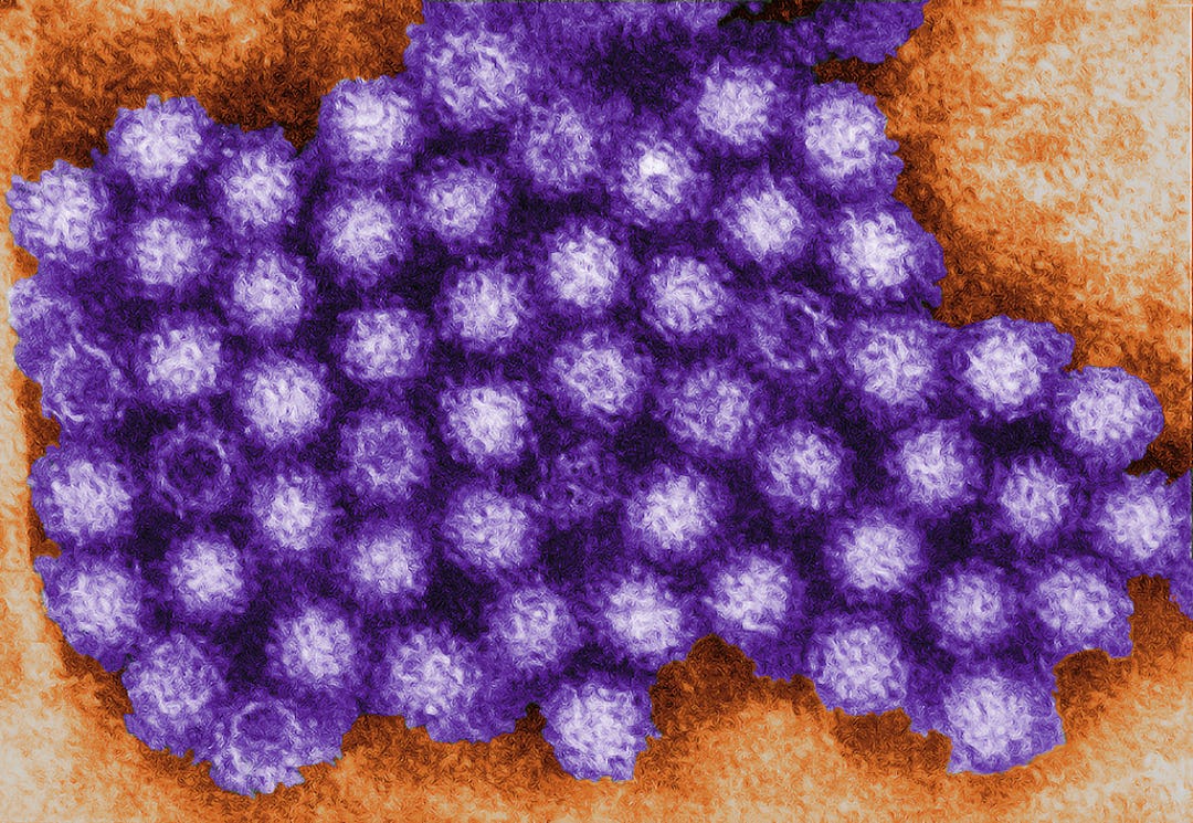 Does Hydrogen Peroxide Kill Norovirus? The Bug Is Highly Contagious