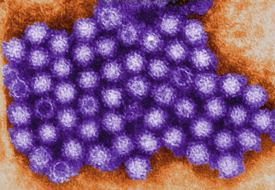 Hydrogen peroxide can kill norovirus, a highly contagious and hard-to-kill bug.