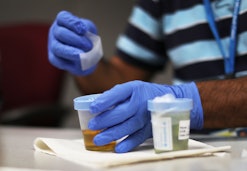 A man preparing two bottles with components for drug testing Medicaid