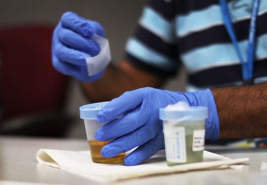 A man preparing two bottles with components for drug testing Medicaid