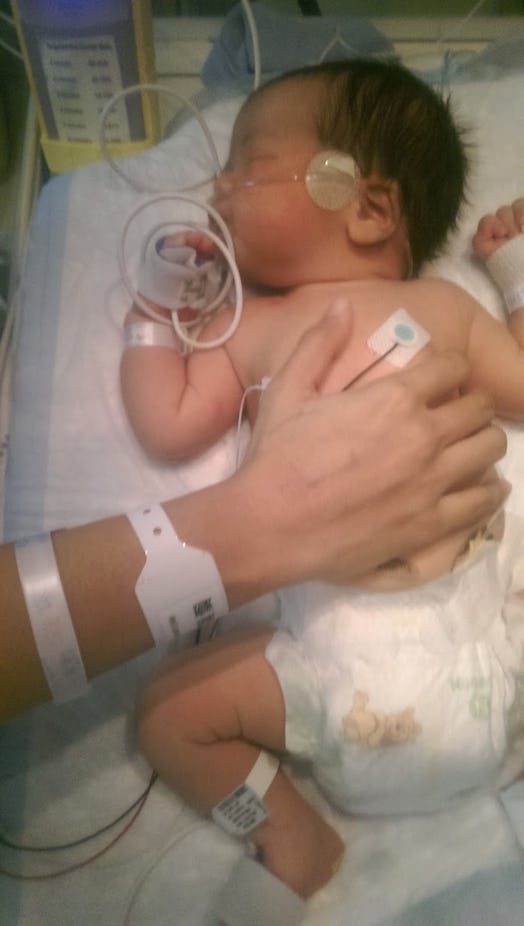 A baby in a hospital with a breathing tube in its nose, while the mother's hand is on the baby's sto...