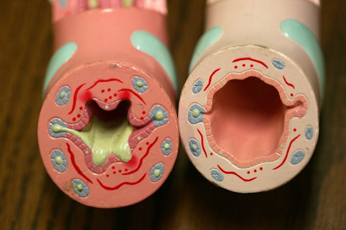 Two plastic bronchiole models showing the science behind asthma attacks