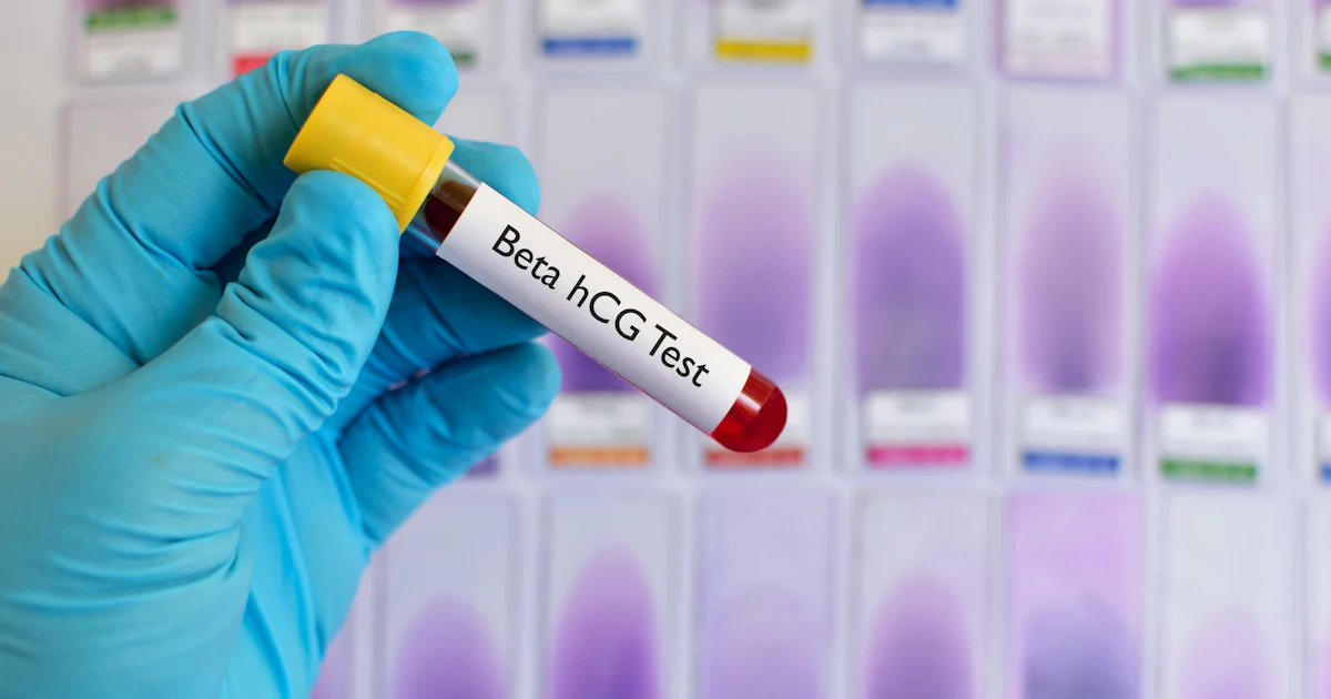 What Does A Low HCG Level Mean It Depends