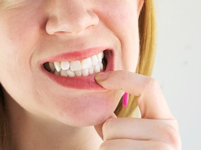 Best teeth whitening for fillings