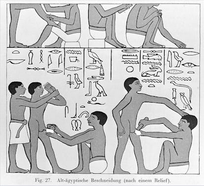 Bizarre Std Treatments From History Bizarre Std Treatments From History