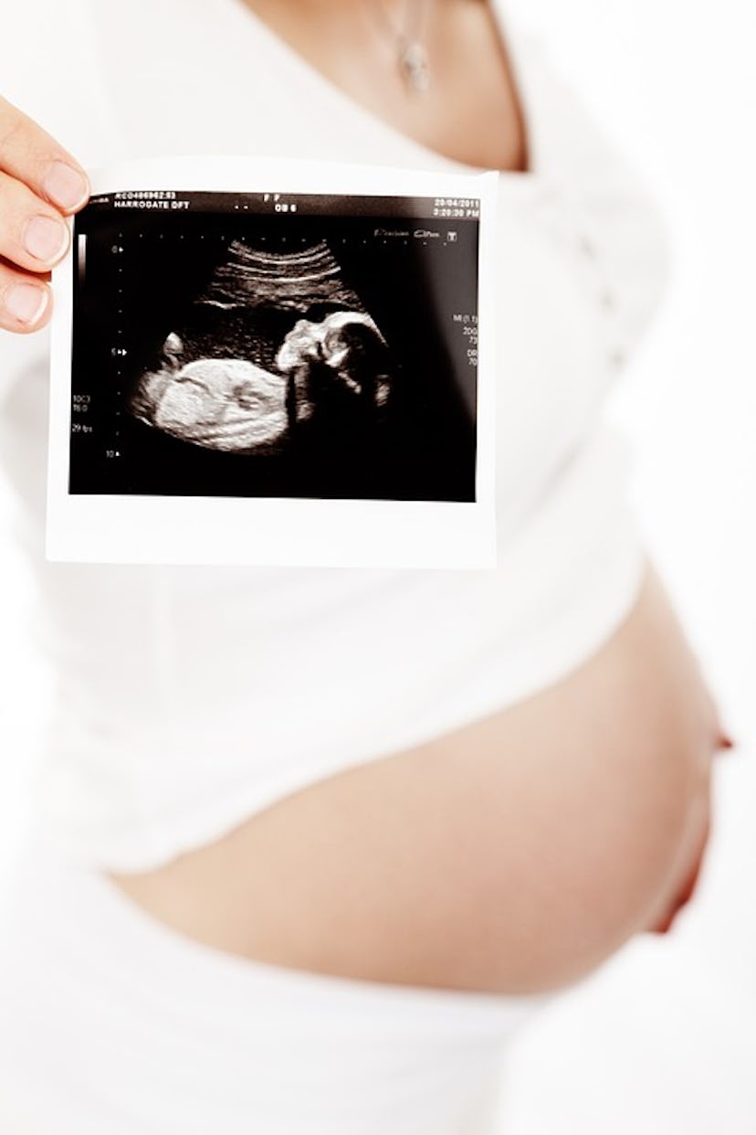 A pregnant woman wearing white holding an image of her ultrasound