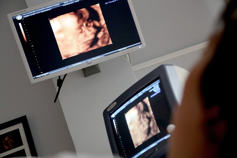 A pregnant woman looking her ultrasound on a screen 