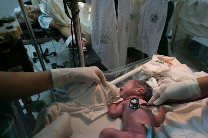 A newborn that has been just delivered after a C-section
