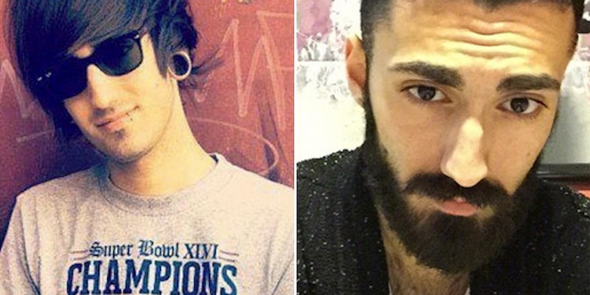 Before And After Photos Prove Men Always Look Better With Beards