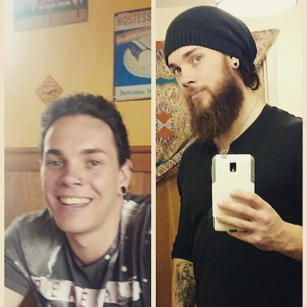 Before And After Photos Prove Men Always Look Better With Beards