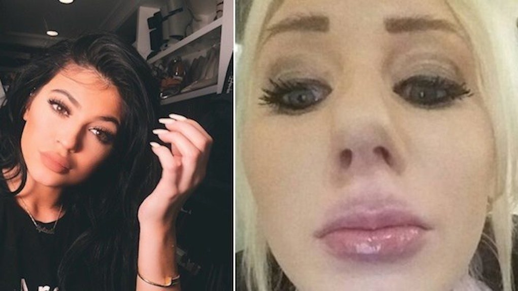 Woman Uses Hairspray Bottle To Get Kylie Jenner Lips Fails Miserably