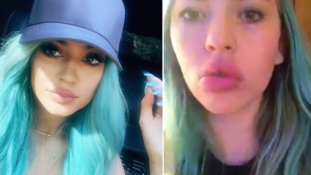 Teens Are Actually Taking The Kylie Jenner Challenge To Get Big Lips