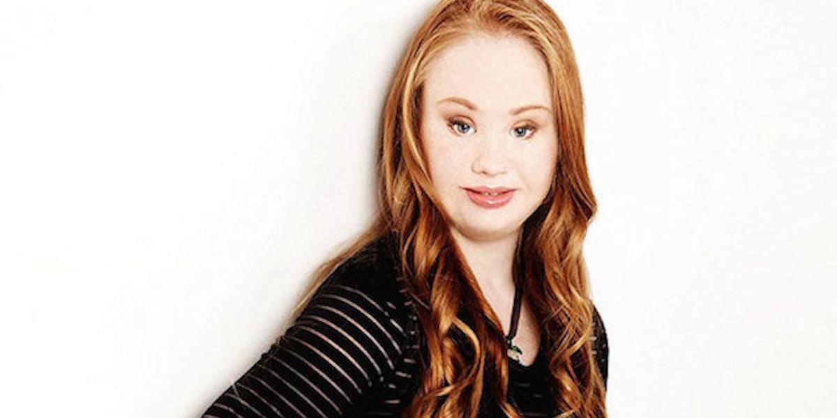 Teenager With Down Syndrome Is Owning Her Dreams Of Becoming A Model 
