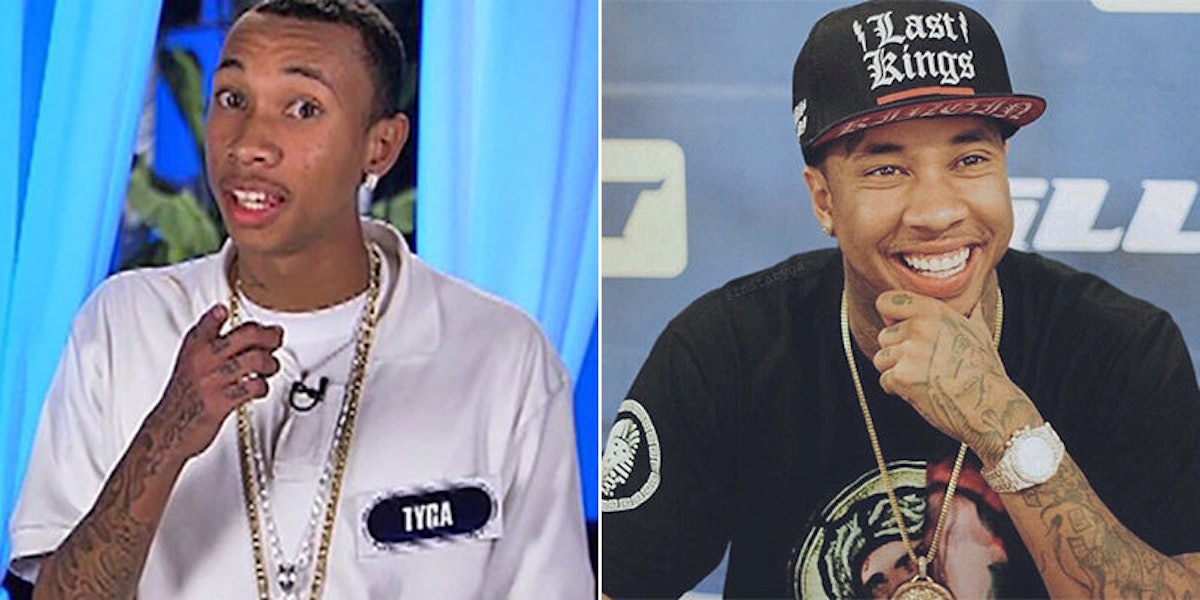 tyga before and after