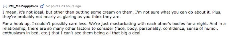 Guys Confess How They Really Feel About Your Flaws When You're Naked