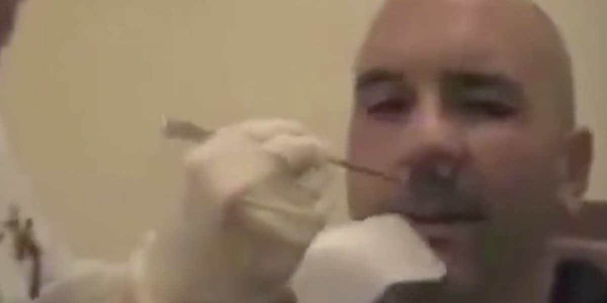 Video Of Doctor Removing 5 Foot Tapeworm From Mans Nose Goes Viral 