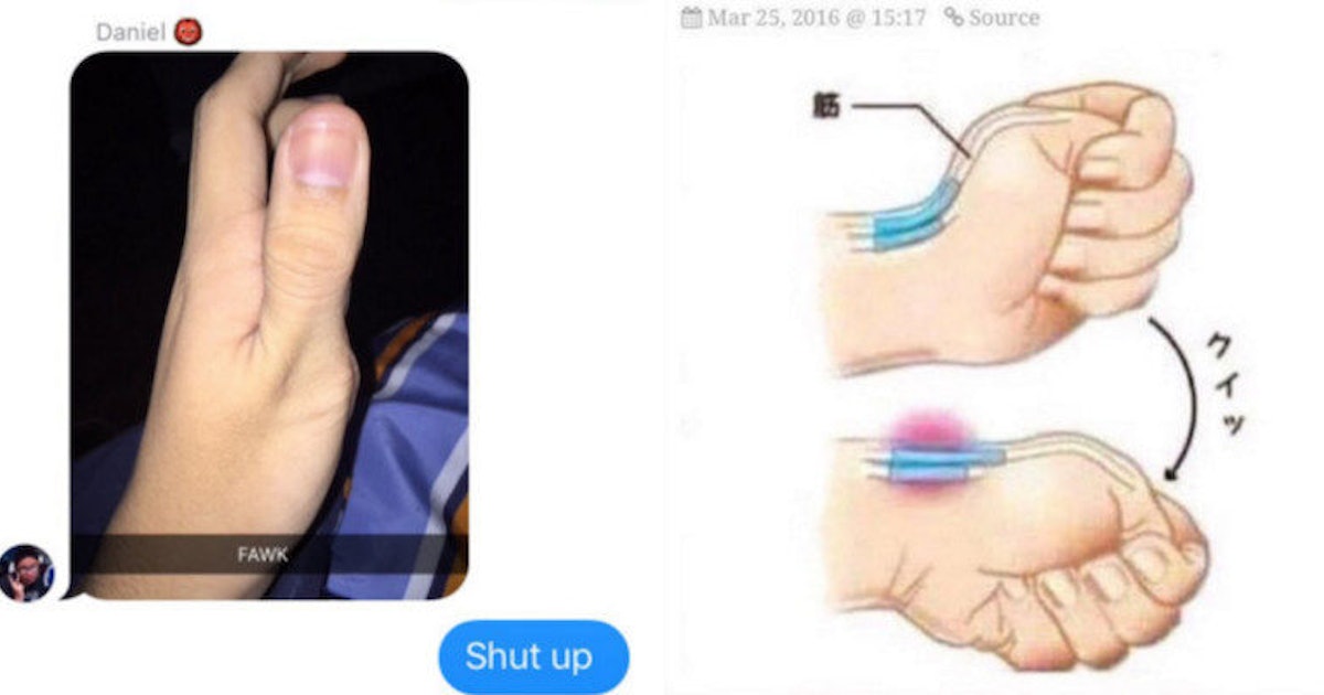Scary Meme Claims To Show You How To Break Your Thumb