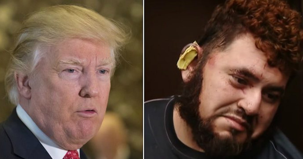 🔥 25+ best memes about we should replace oxygen with dank Man Bites Off Roommate's Ear In Fight Over Donald Trump