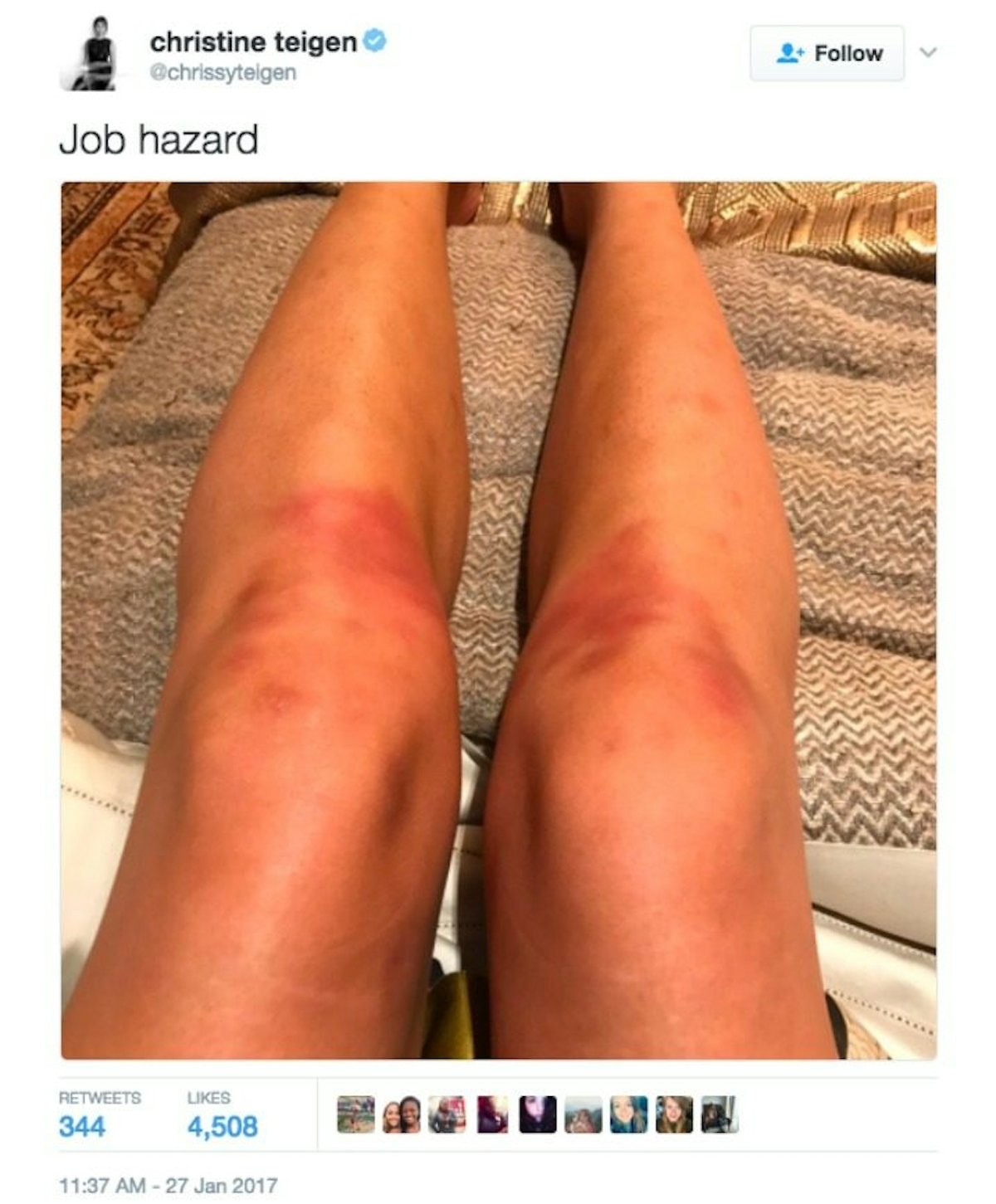 Bruises legs sex on What Causes
