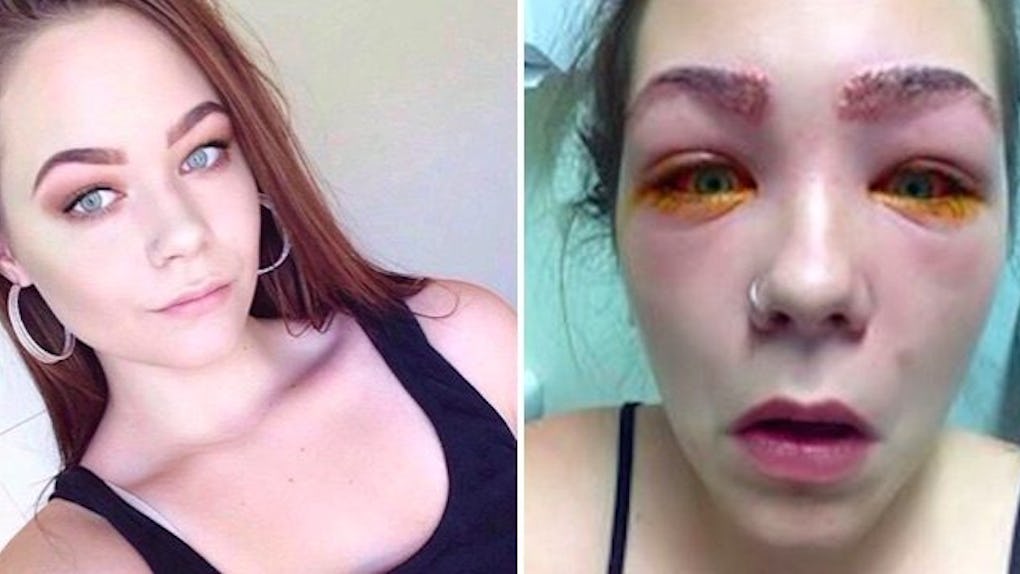 Teen S Side By Side Pics Show Reaction To Eyebrow Tint reaction to eyebrow tint