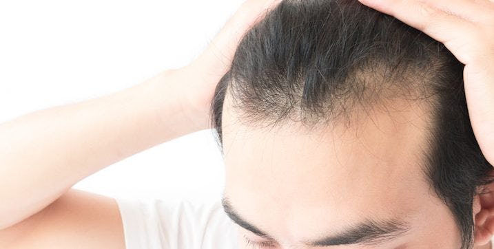 Popular Hair Loss Medications Give Guys Erectile Dysfunction