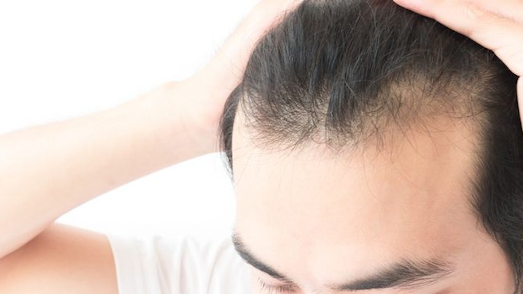Popular Hair Loss Medications Give Guys Erectile Dysfunction