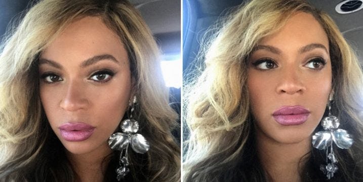 Beyoncé Fans Think She Got Lip Injections After Recent Pics